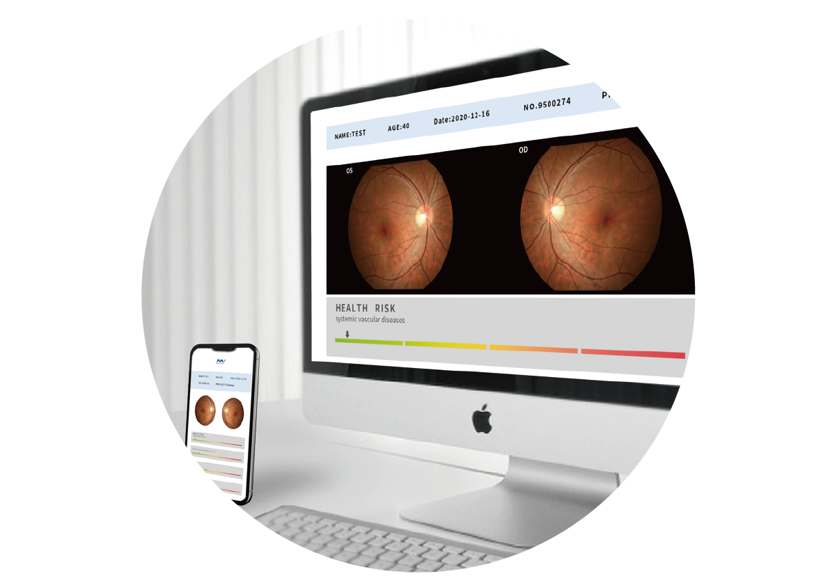 Automatic Fundus Camera FC162_20230613-09.png