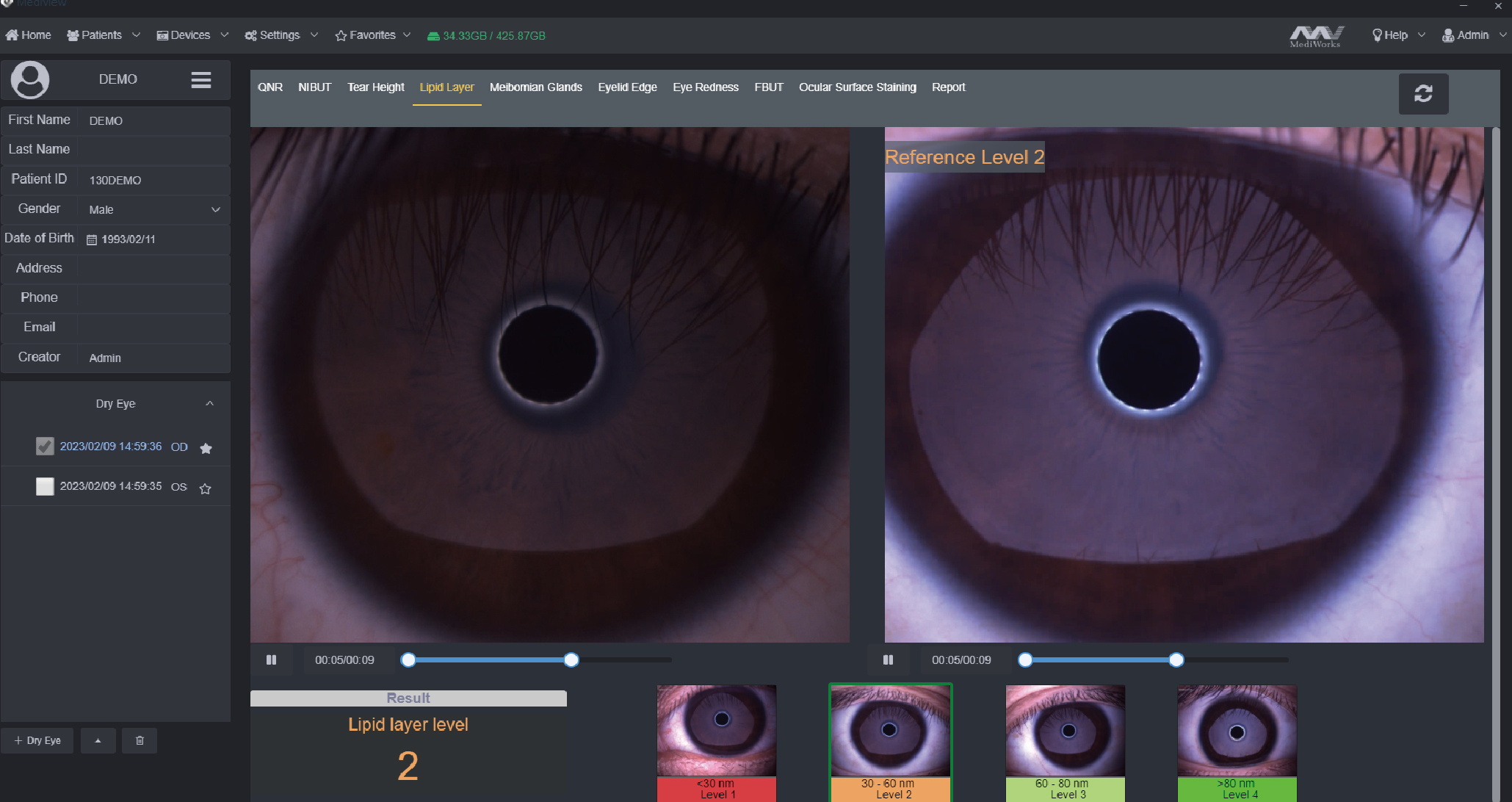 Dry eye diagnostic system_20230612-17.jpg