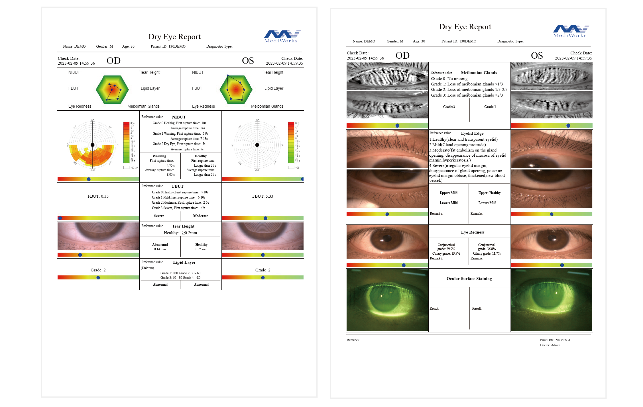 Dry eye diagnostic system_20230612-21.png
