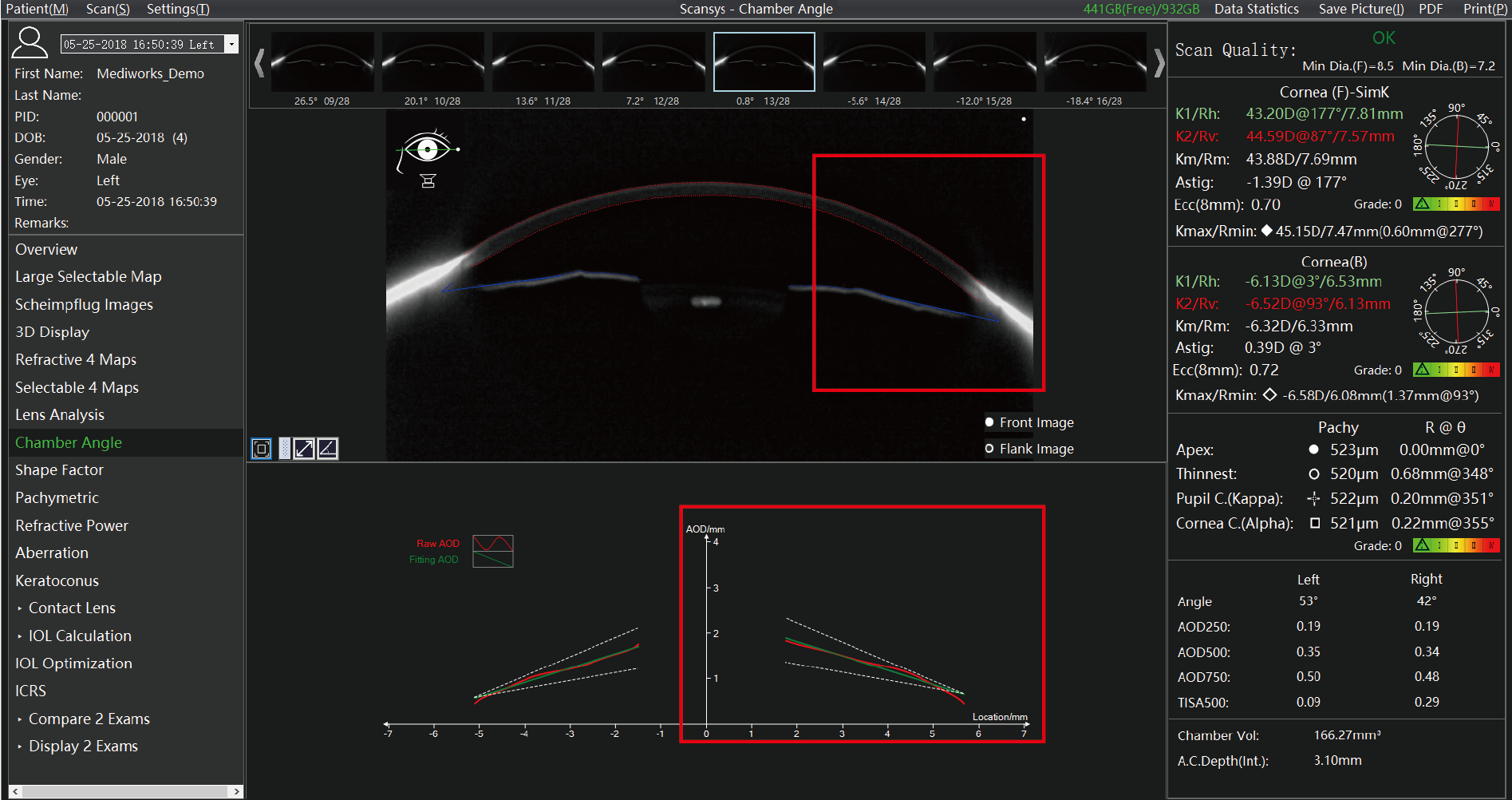 Analizador de segmento anterior Scansys TA 517_20230609-17.png