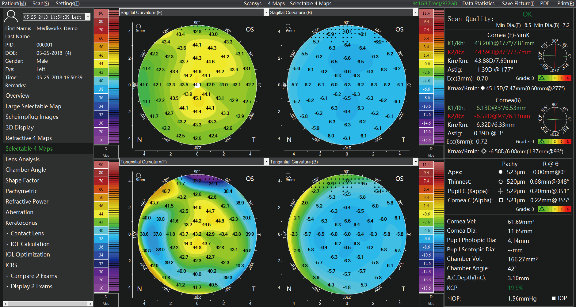 Analyseur de segment antérieur Scansys TA 517_20230609-19.png