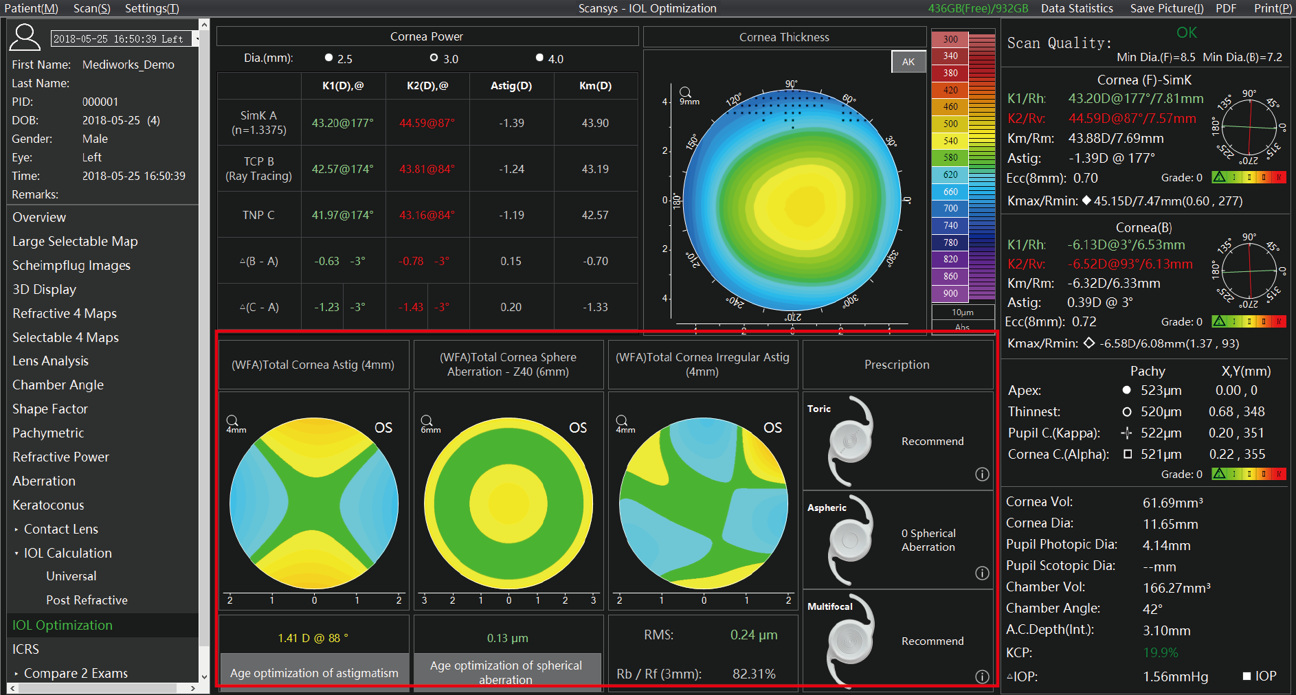 Analizador de segmento anterior Scansys TA 517_20230609-10.png