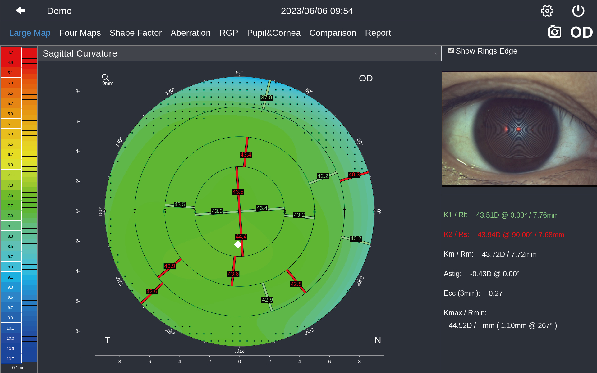 Corneal Topographer DEA520_20230801 - 副本-15.jpg