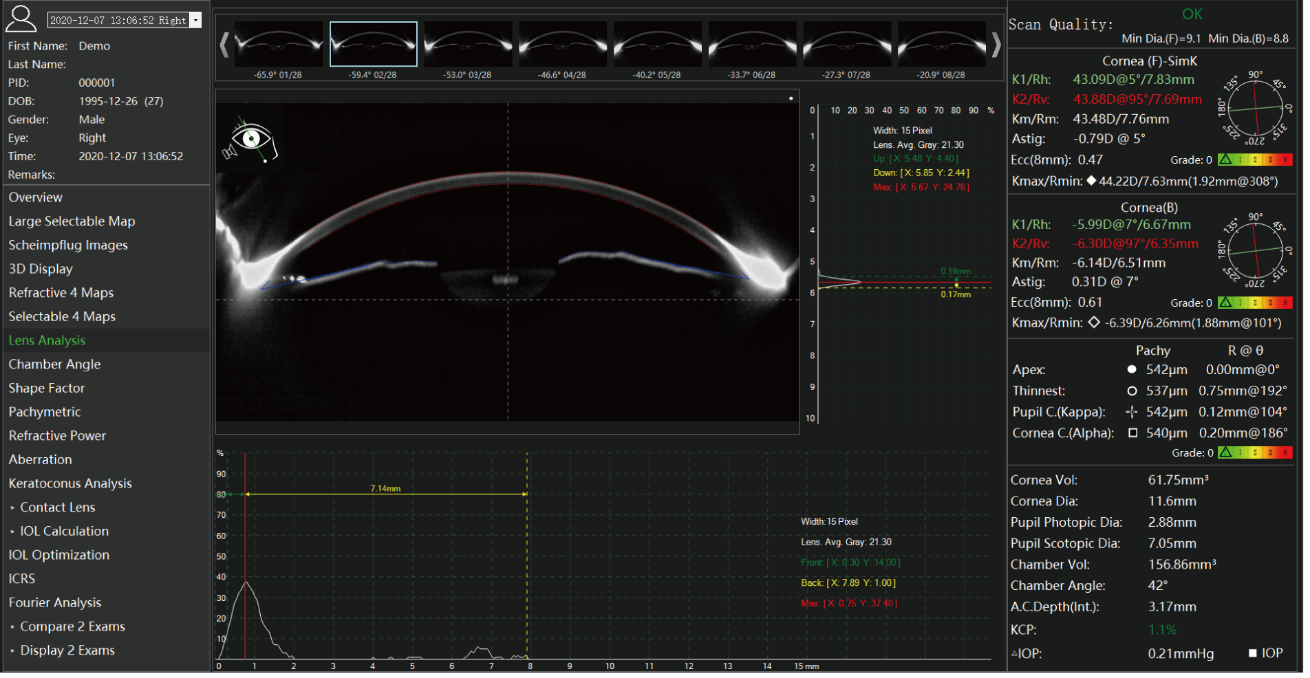 TA 517 Scansys Anterior Segment Analyzer 20230912-16.png