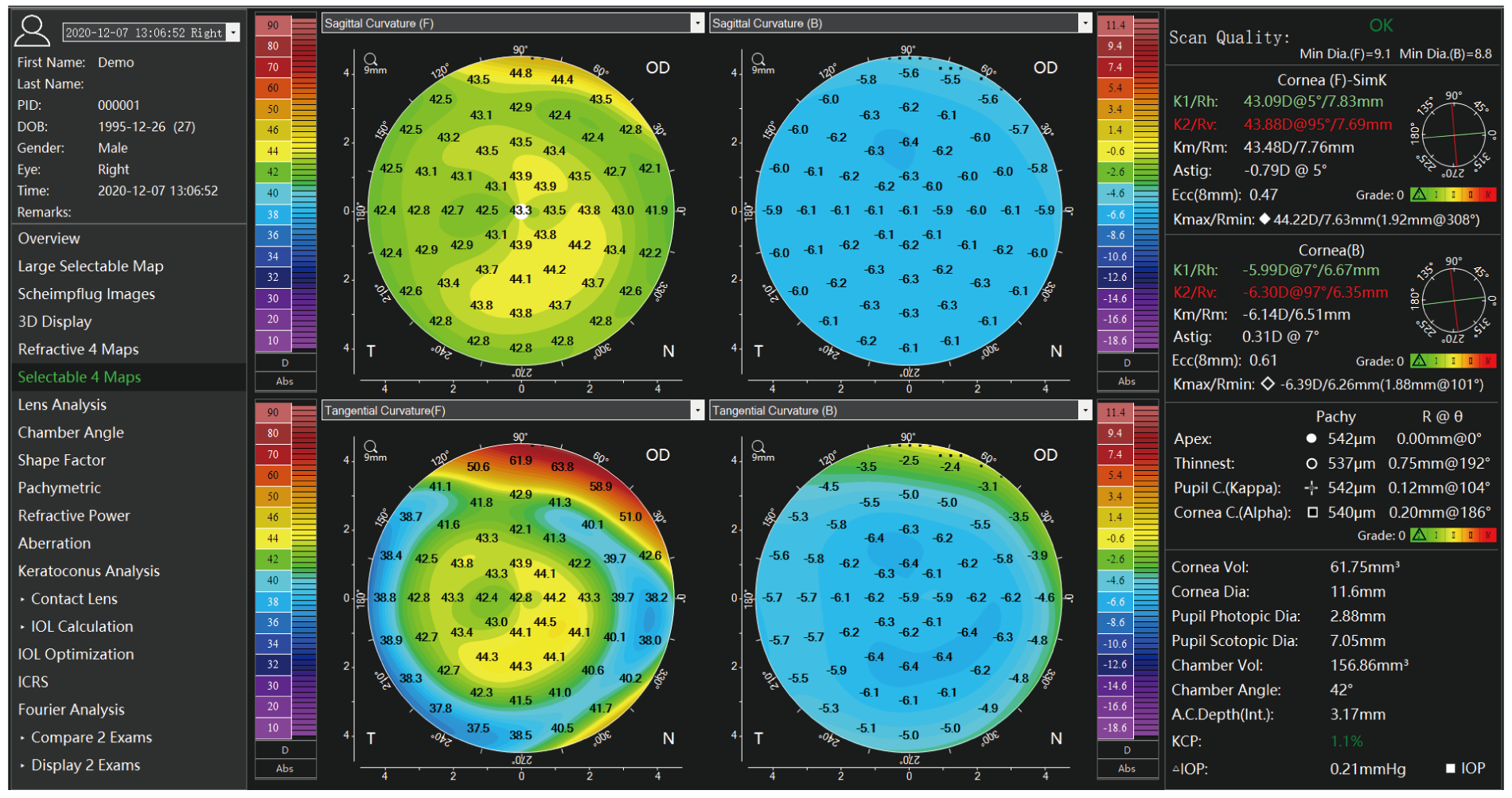 TA 517 Scansys Anterior Segment Analyzer 20230912-10.png