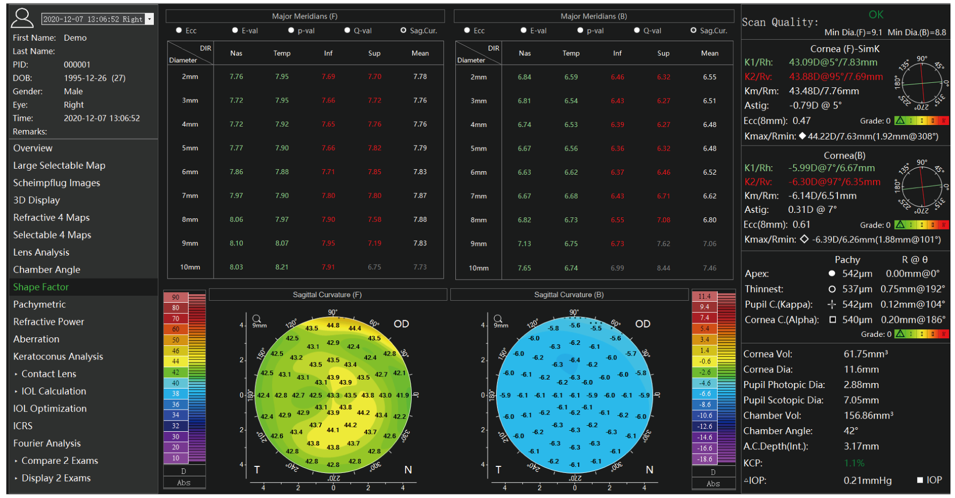 Analyseur de segment antérieur TA 517 Scansys 20230912-14.png