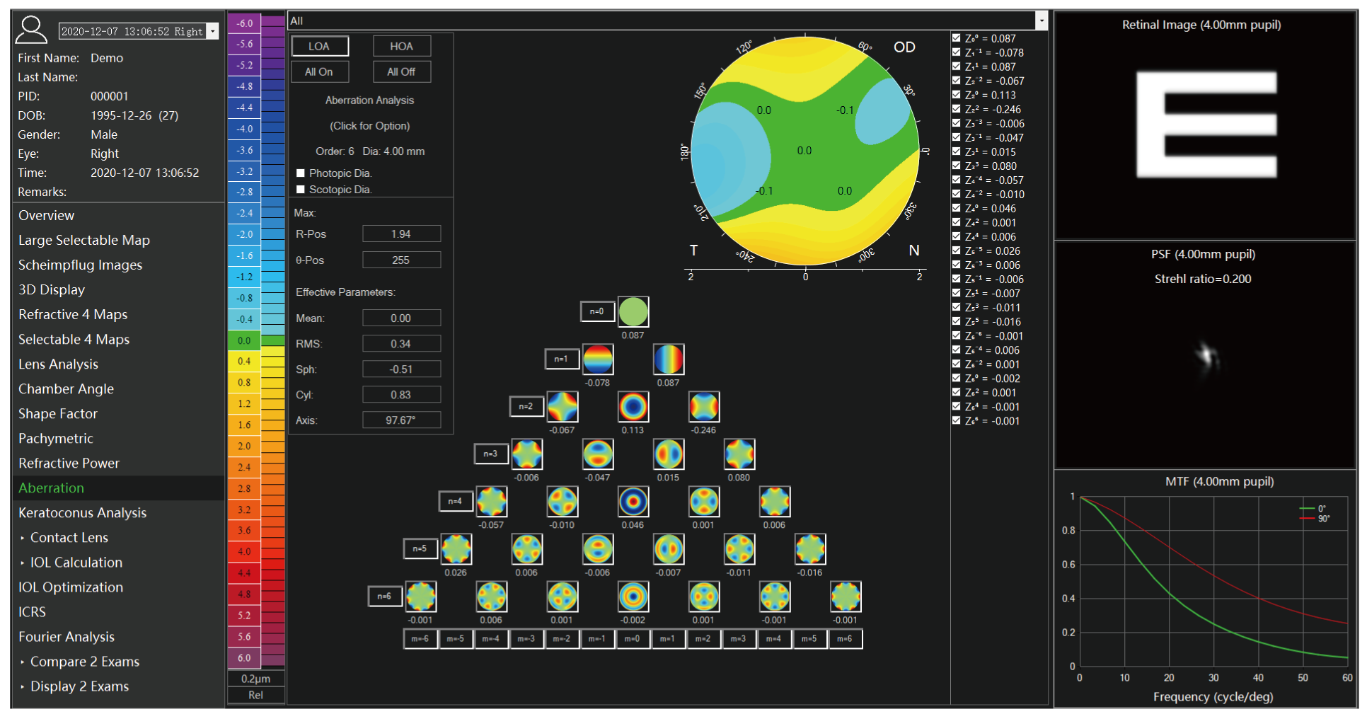 Analyseur de segment antérieur TA 517 Scansys 20230912-11.png