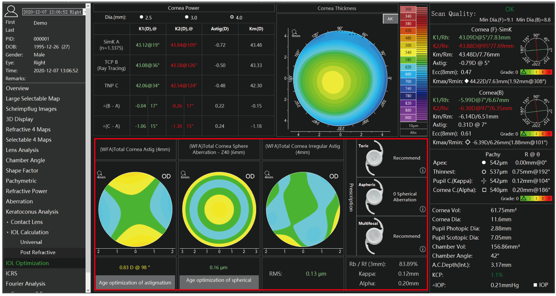 Analyseur de segment antérieur TA 517 Scansys 20230912-13.png