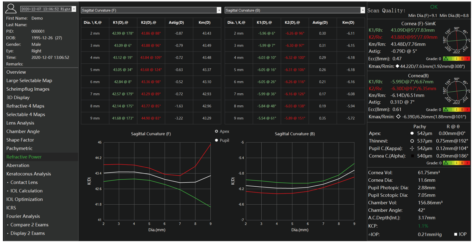 TA 517 Scansys Anterior Segment Analyzer 20230912-12.png