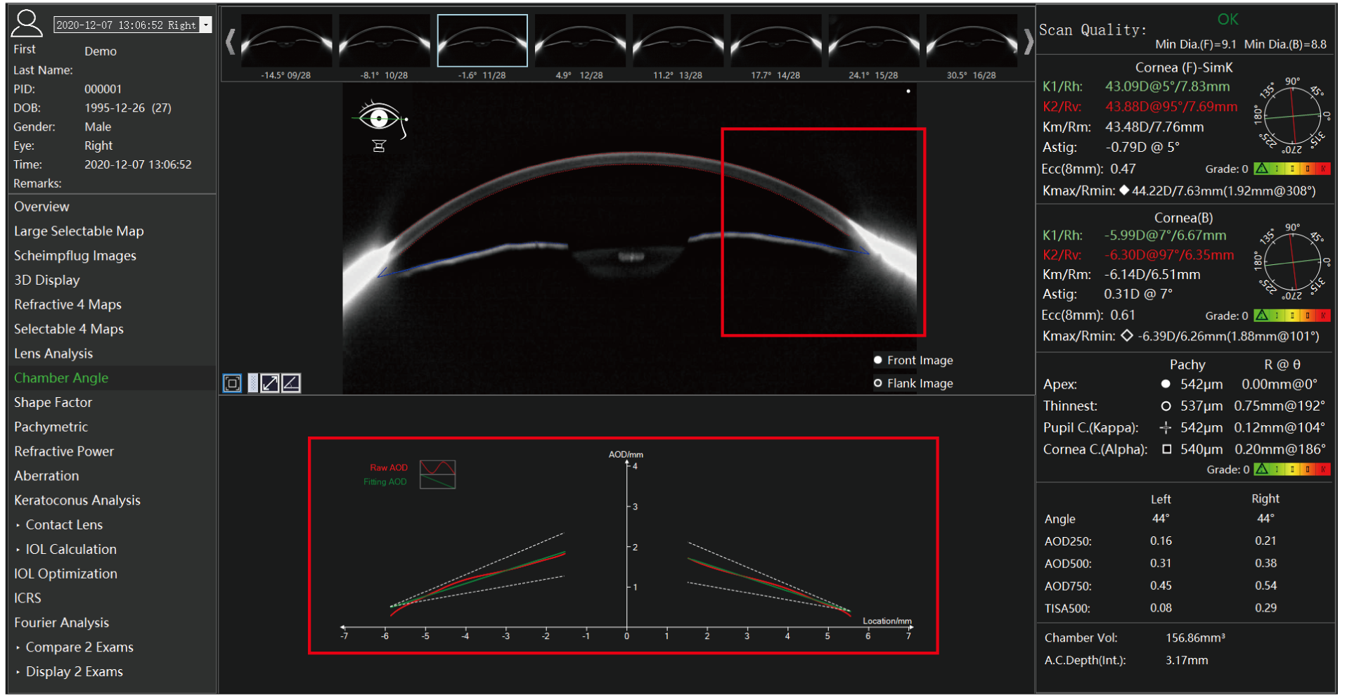 Analyseur de segment antérieur TA 517 Scansys 20230912-20.png