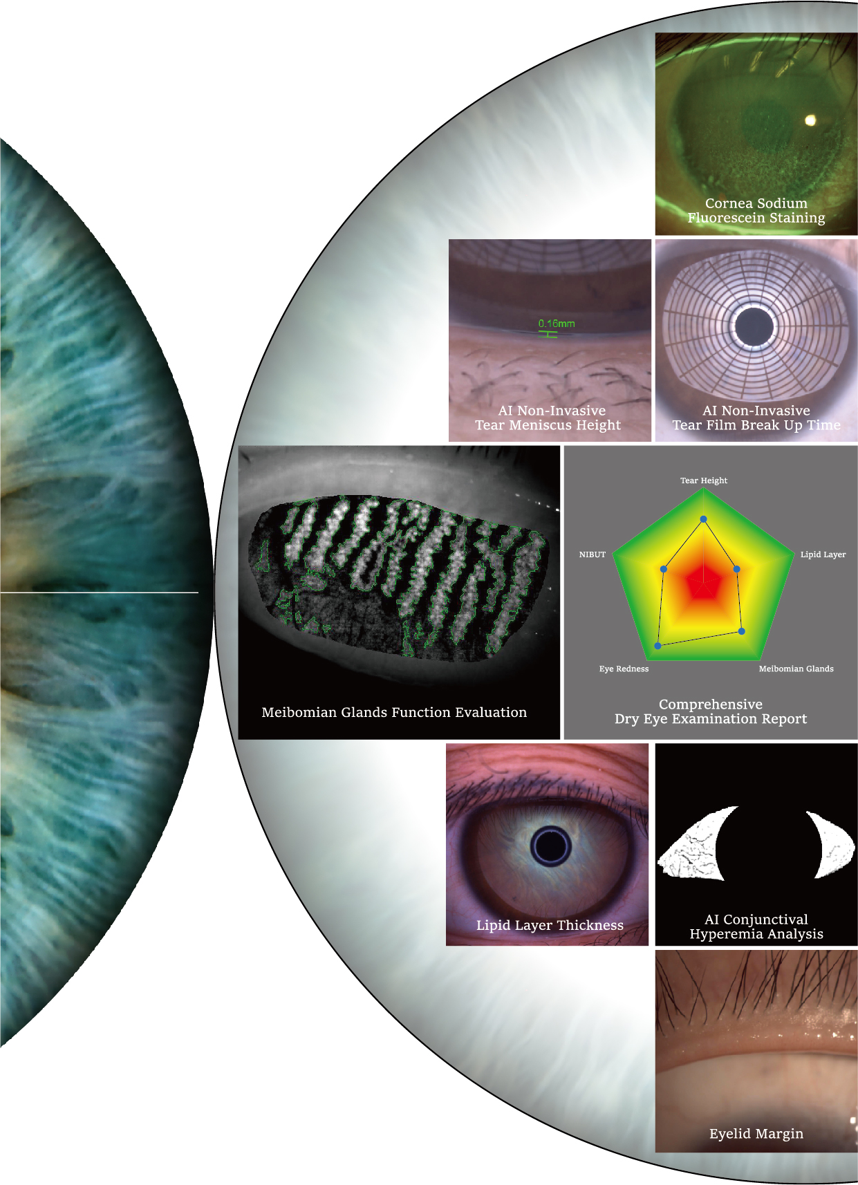 How to Choose the Right Dry Eye Examination Equipment