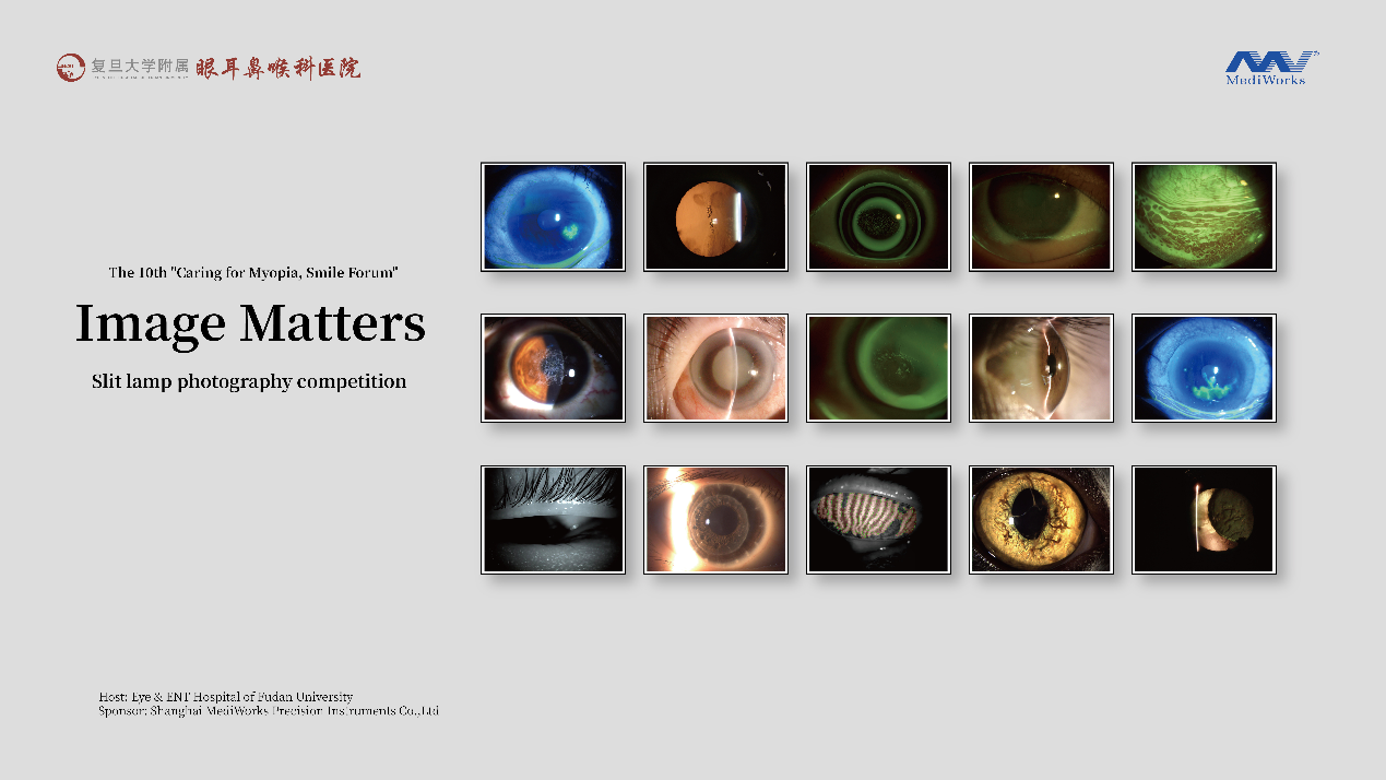 Slit Lamp Photo Competition Sponsored by MediWorks Raises Ophthalmology’s Significance