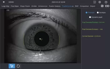 Pupil & Corneal Diameter  Measurement
