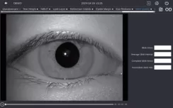 Blink Quality