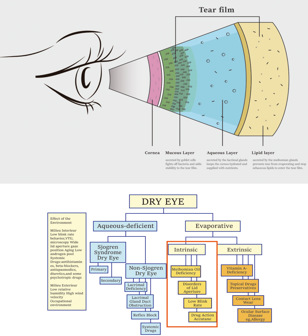 To Fulfill Dry Eye Diagnosis, You Need A Professional Device