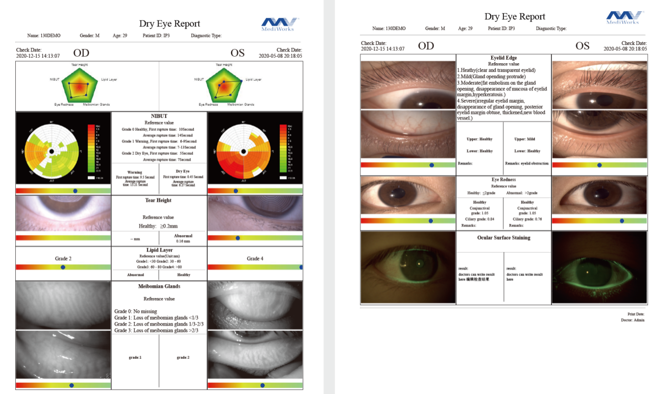 To Fulfill Dry Eye Diagnosis, You Need A Professional Device