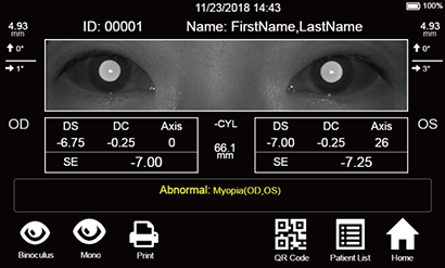 5 Suggestions You Need to Consider Before Choosing a Vision Screener