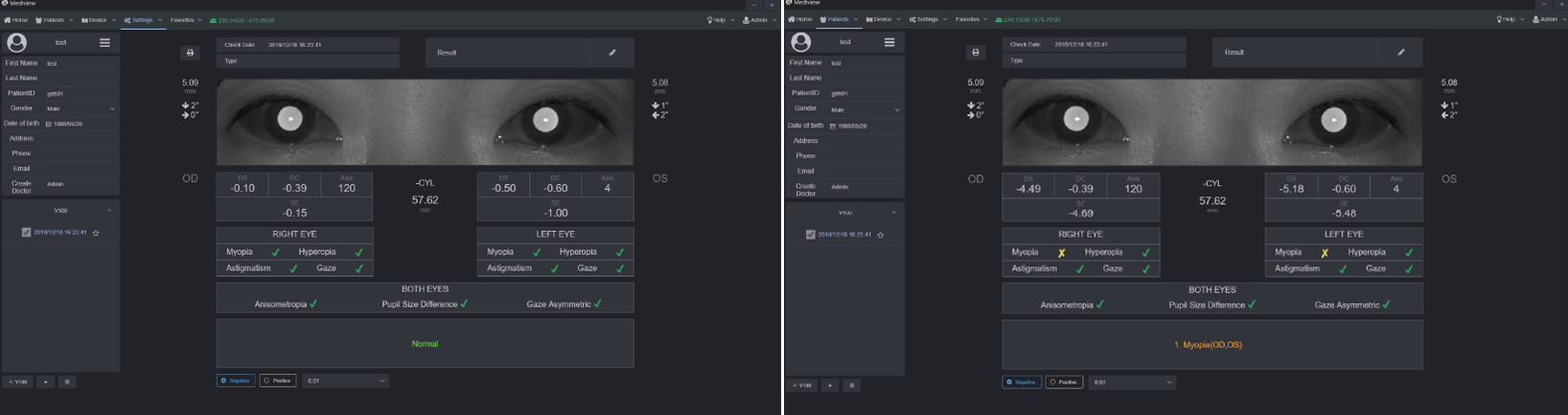 5 Suggestions You Need to Consider Before Choosing a Vision Screener