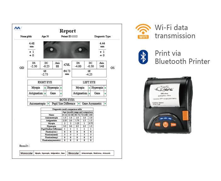 5 Suggestions You Need to Consider Before Choosing a Vision Screener