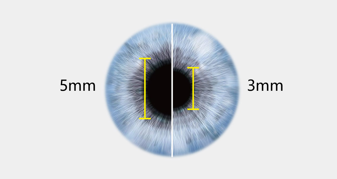 How A Hand Held Fundus Camera Benefits Us?cid=9