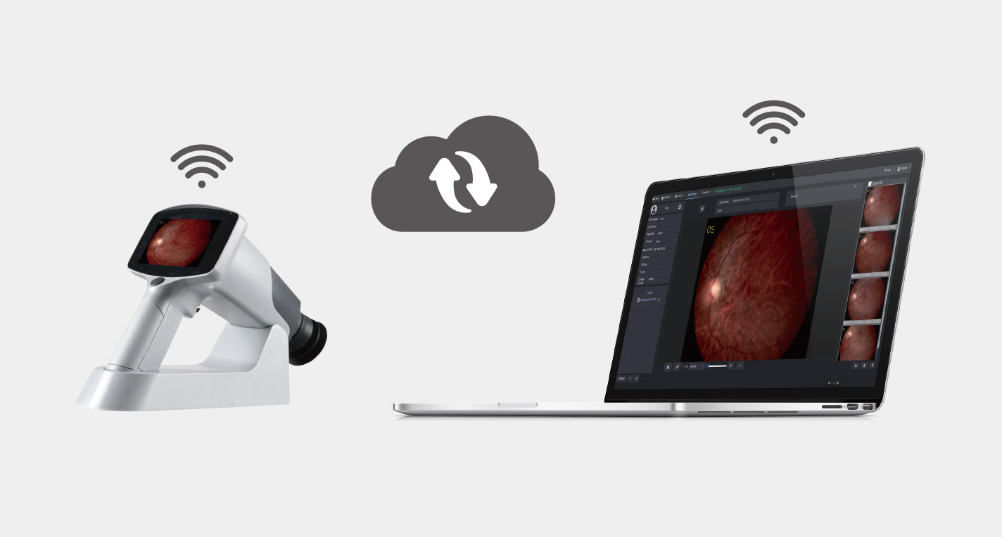How A Hand Held Fundus Camera Benefits Us?cid=9