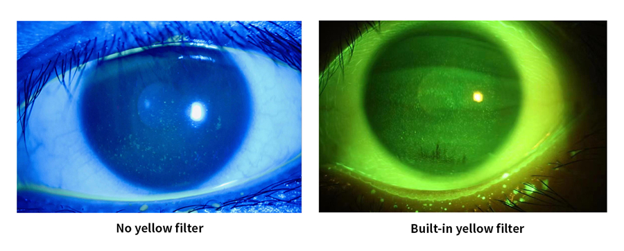 S390L Slit Lamp Microscope