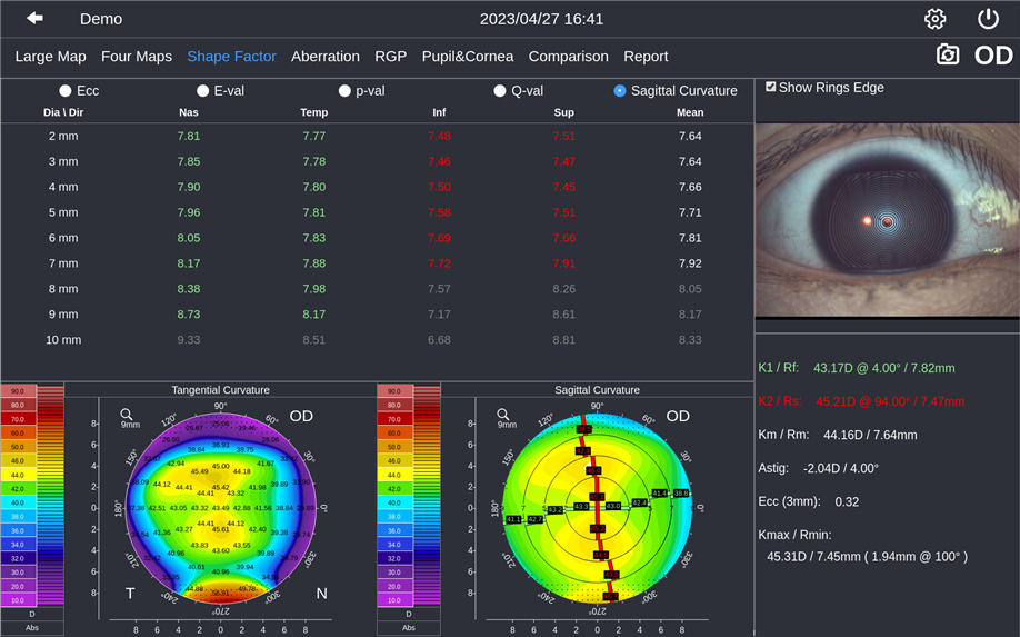 Analysis and application of corneal morphological parameters