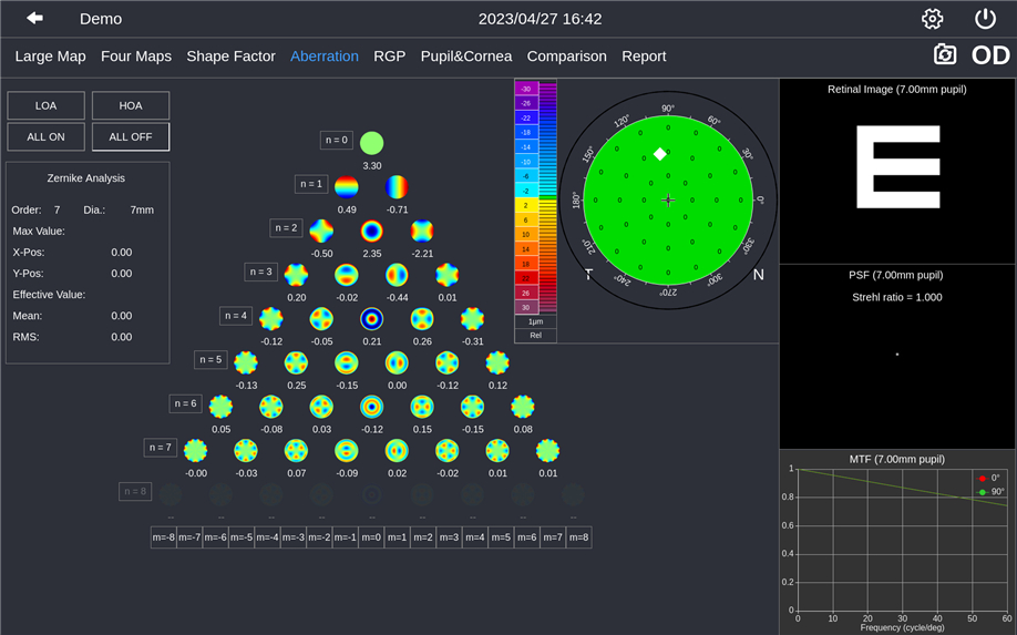 Analysis and application of corneal morphological parameters