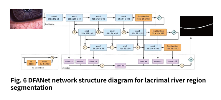 Tear meniscus height detection based on deep learning