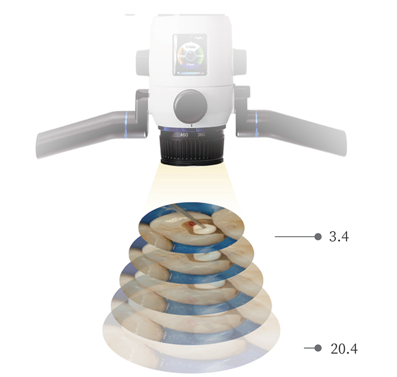 Continuous Zoom System