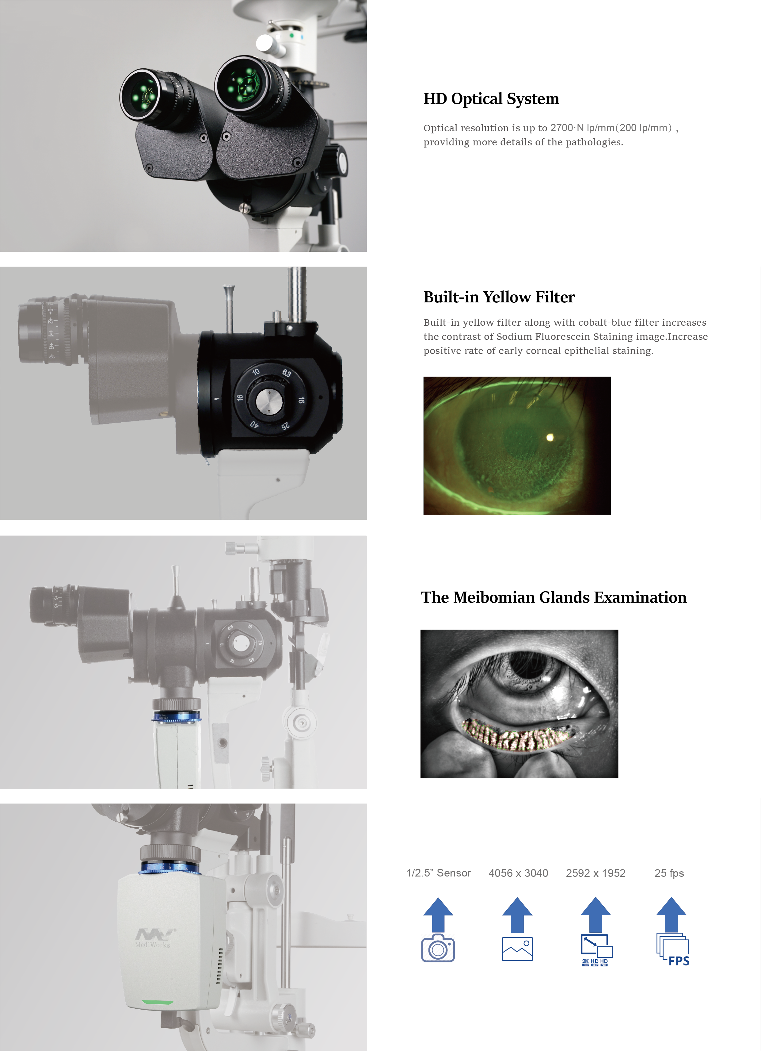 Digital Slit Lamp(S390L   S290)