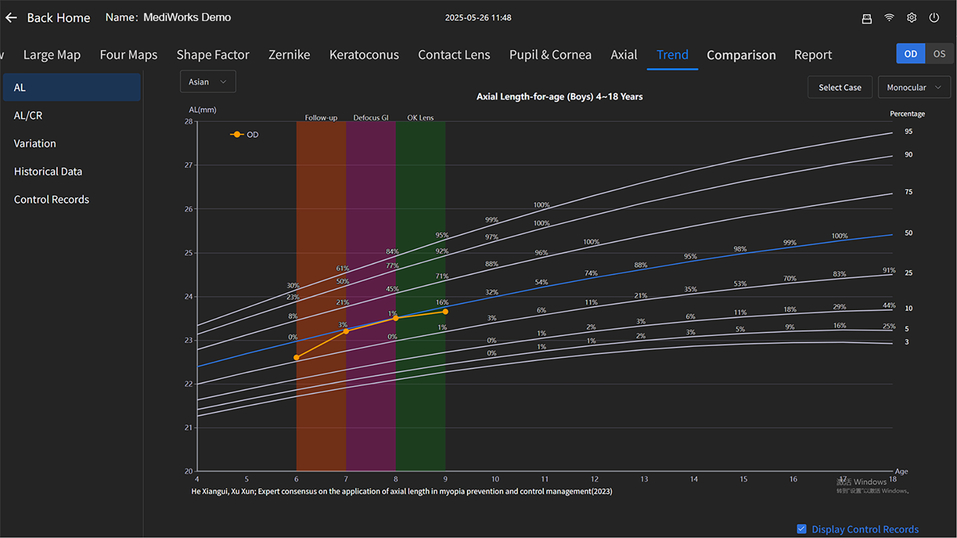 Myopia Progression Monitoring