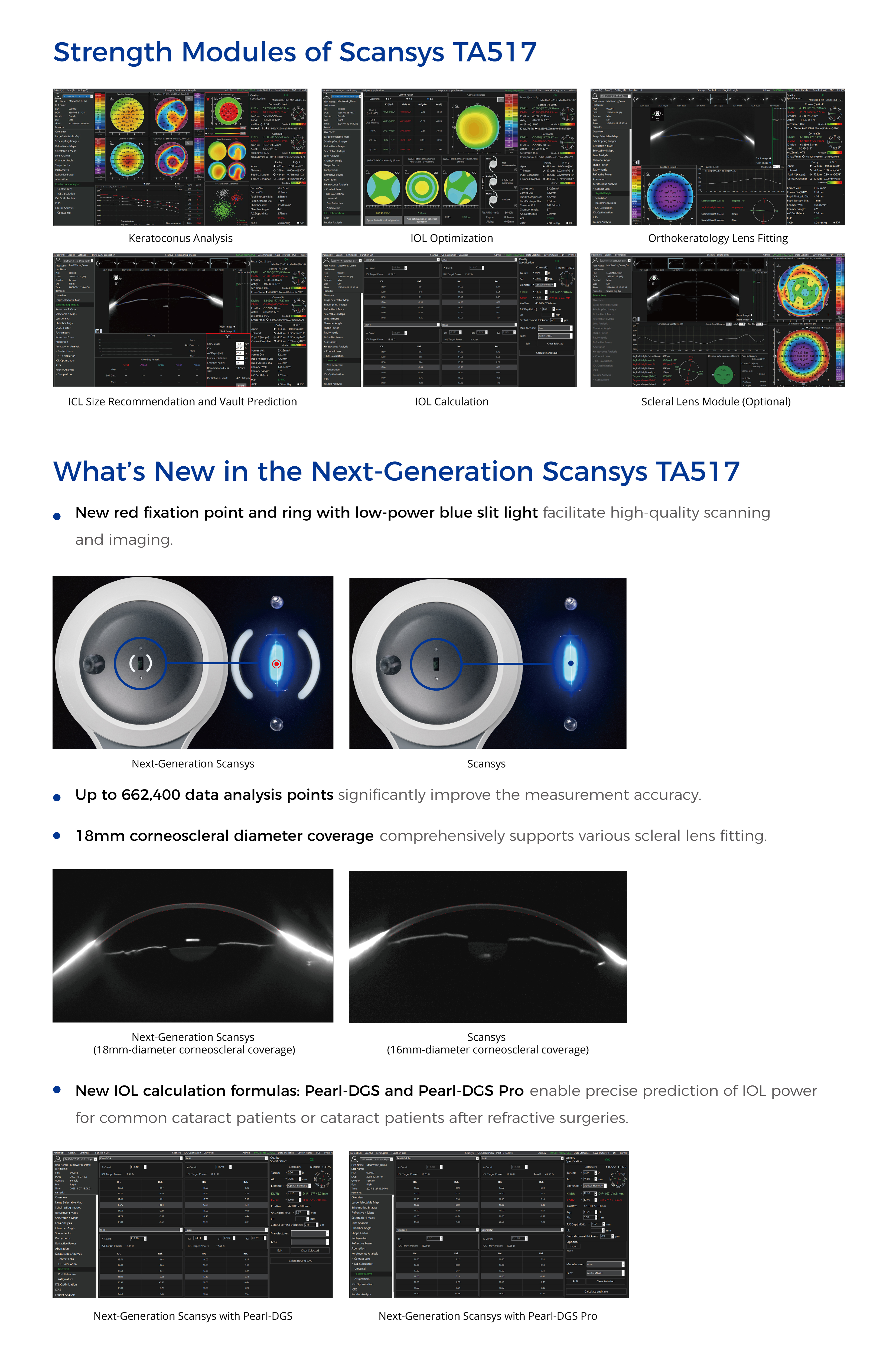 Scansys TA517 3D Anterior Segment Analyzer