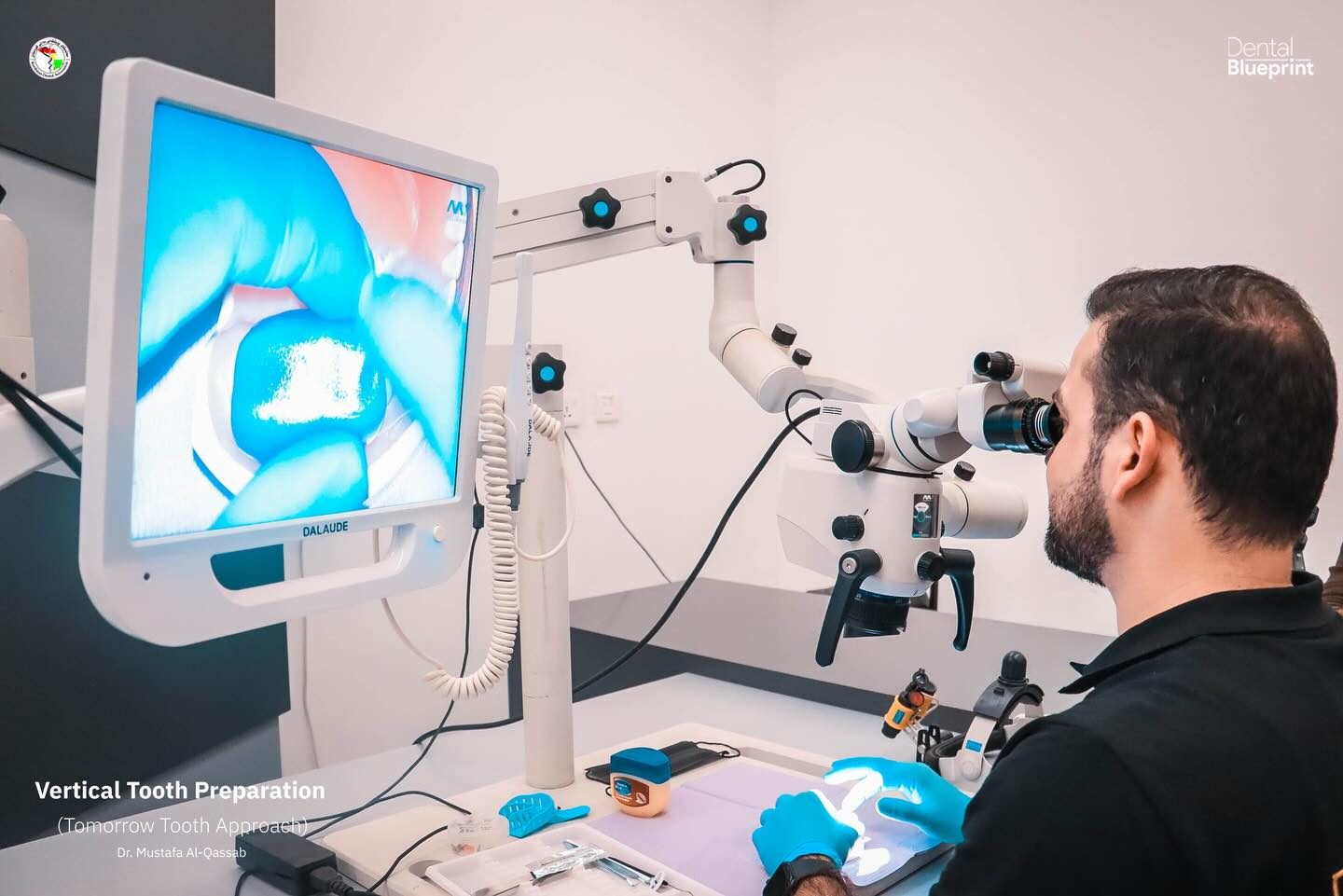 Dr. Mustafa Al-Qassab Hosts Vertical Tooth Preparation Masterclass in Iraq, Highlighting the Role of Dental Surgical Microscopes