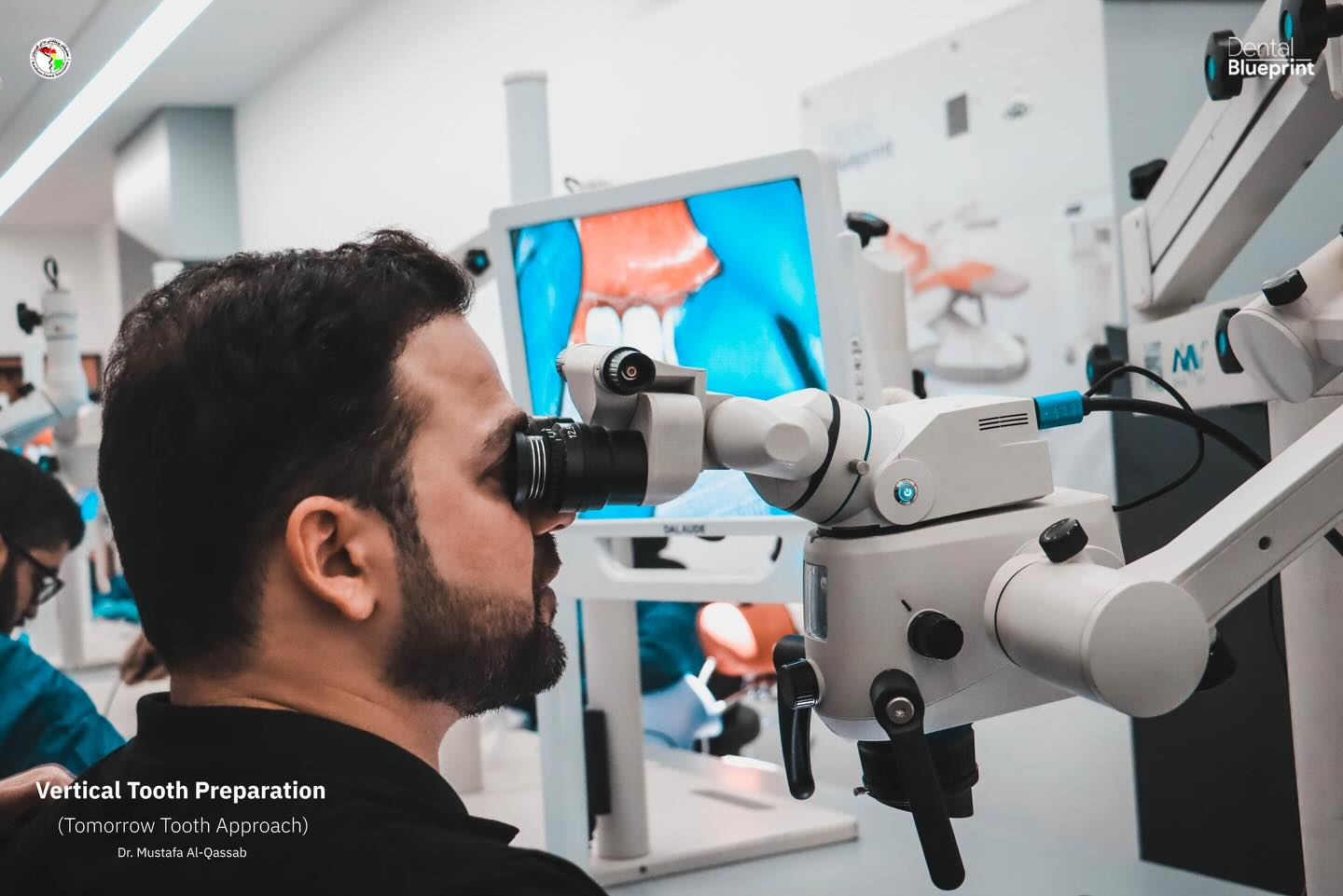 Dr. Mustafa Al-Qassab Hosts Vertical Tooth Preparation Masterclass in Iraq, Highlighting the Role of Dental Surgical Microscopes