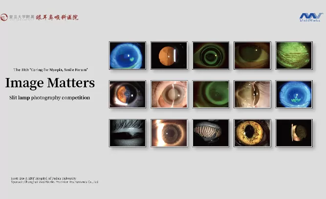 Slit Lamp Photo Competition Sponsored by MediWorks Raises Ophthalmology’s Significance