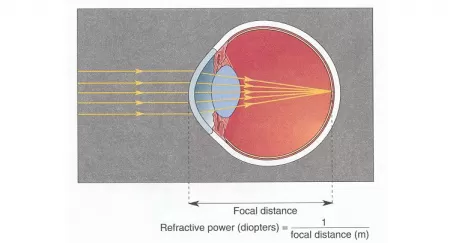 The optics of the eye
