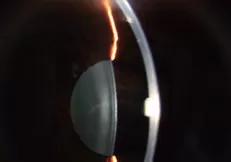 Lens