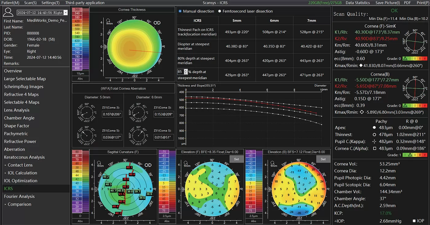 ICRS Implantation Recommendation