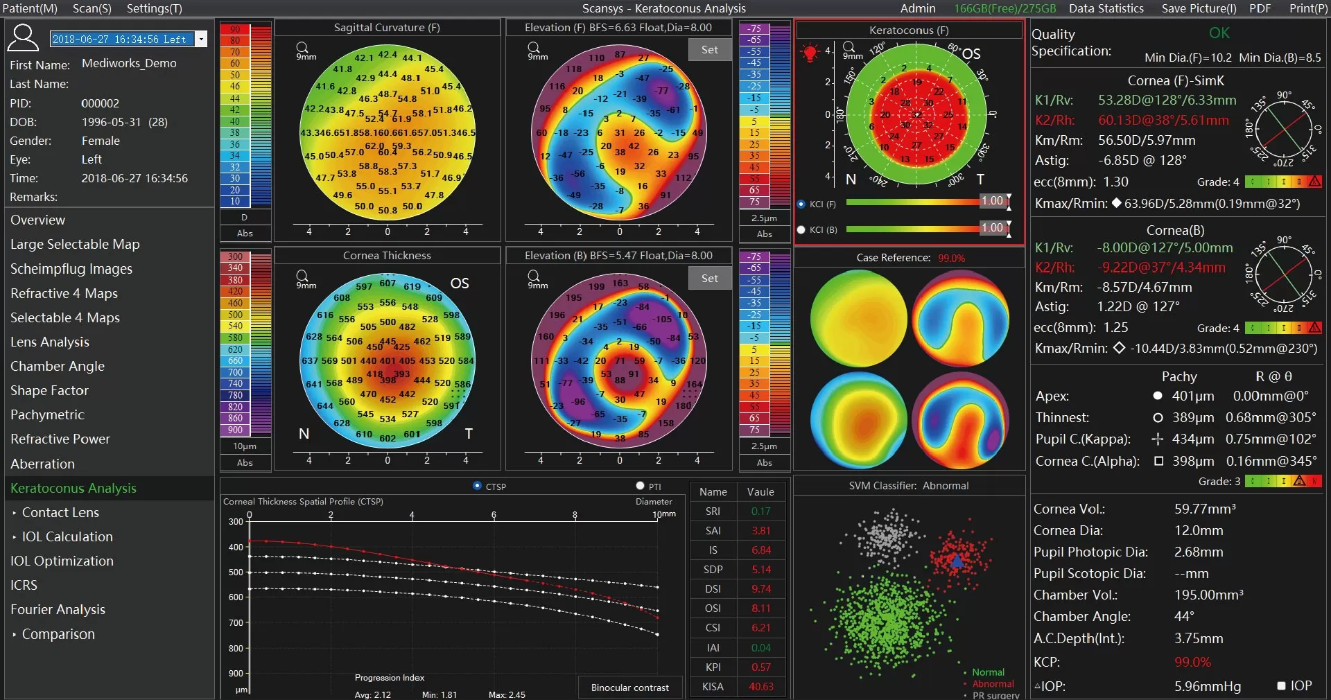 Keratoconus Analysis