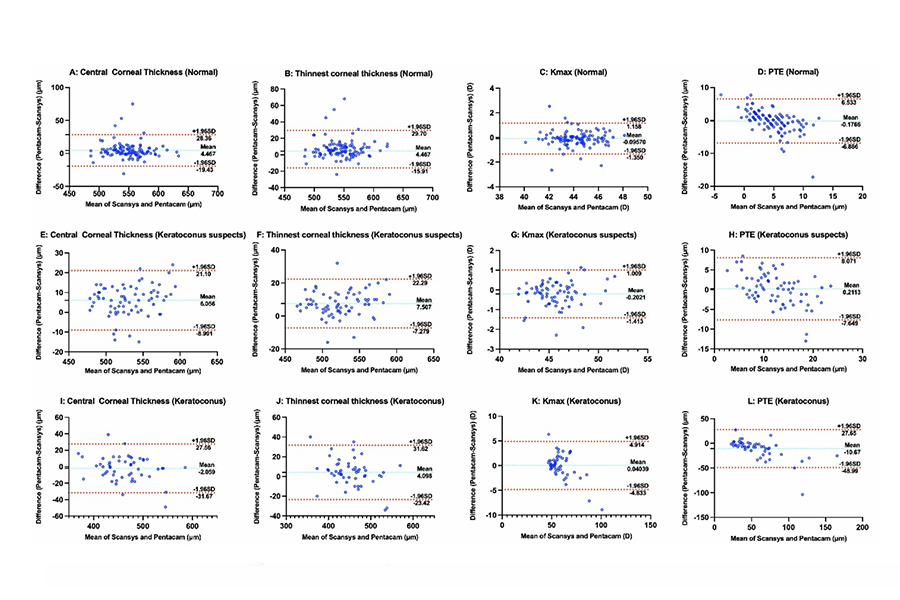 Comparison of a Scheimpflug  imaging with other screening  indices in diagnosing keratoconus  and keratoconus suspect