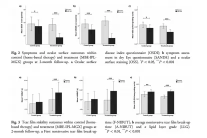 Diamond Bur Microblepharoexfoliation Combined with Intense Pulse Light and Meibomian Gland Expression for Evaporative Dry Eye: A Short-term Controlled Clinical Trial