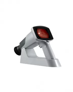 FC161 Hand-held Fundus Camera